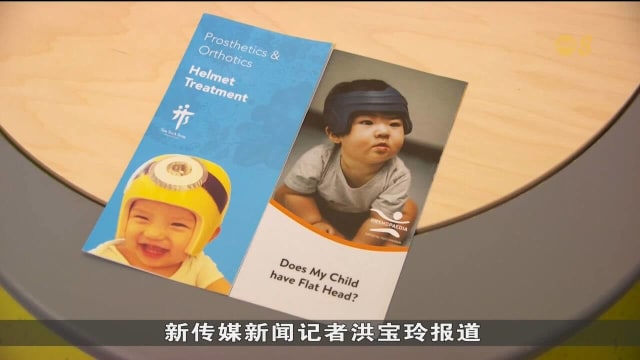 更多父母注意到宝宝扁头情况 医生：多数属轻微水平