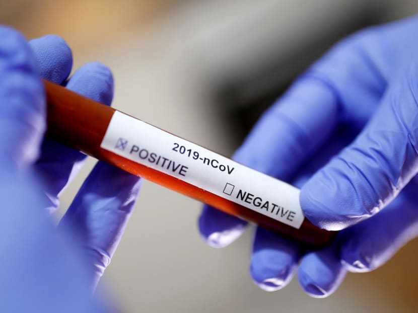 Panasonic Malaysia confirms 116 workers positive for Covid-19 in Shah Alam factories