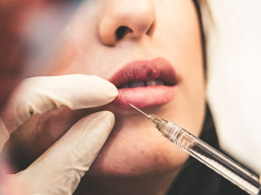 Stock photo of a facial aesthetic procedure.