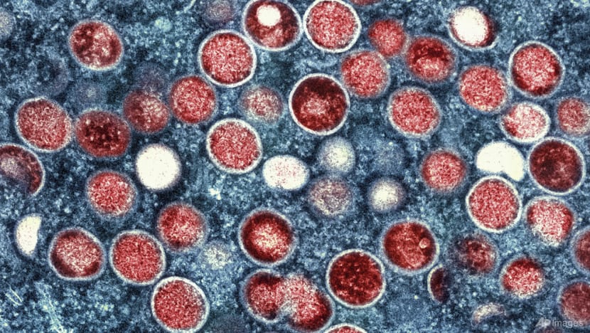 Mpox outbreak in Africa: Immediate risk to Singapore is low, says Health Ministry Mpox outbreak in Africa: Immediate risk to Singapore is low, says Health Ministry