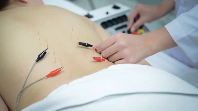 新港科研团队发现 中医电针疗法或有助控制肥胖