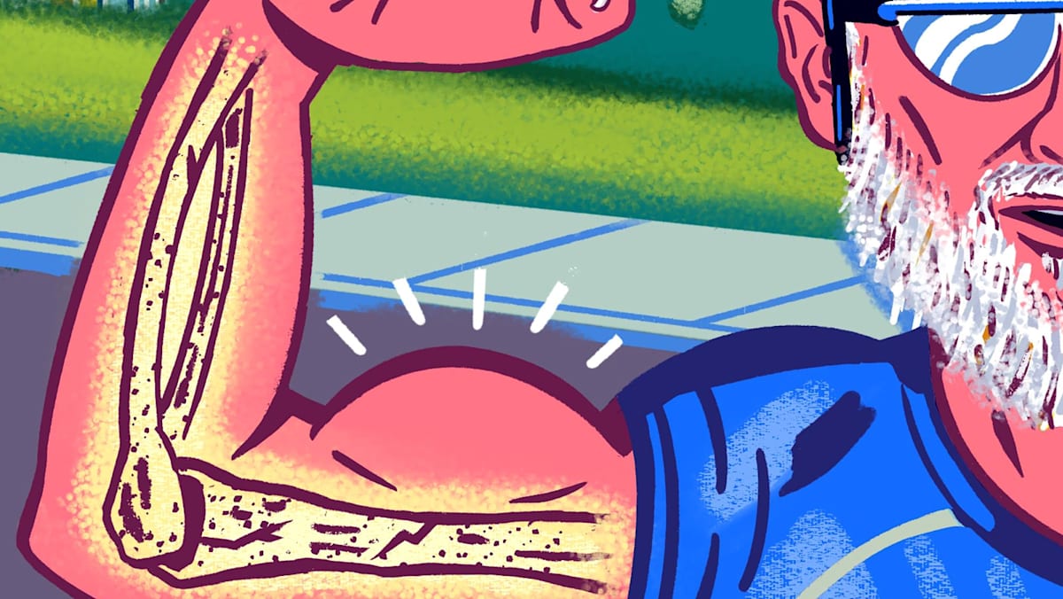 Osteoporosis in men? Why brittle bones aren’t just a woman’s problem Osteoporosis in men? Why brittle bones aren’t just a woman’s problem