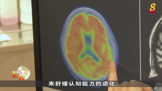 晨光|晨光聚焦：年轻型失智症患者 缺少辅助与支持