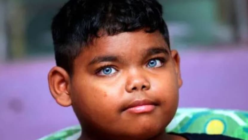 Anak Orang Asli mata biru curi tumpuan orang ramai 