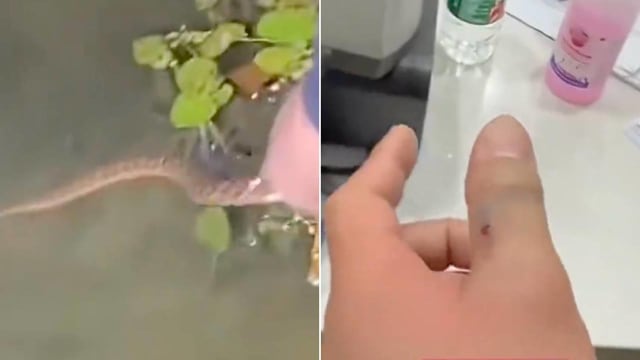 好奇抓短尾蝮蛇被咬伤 男子手肿胀发黑急送医