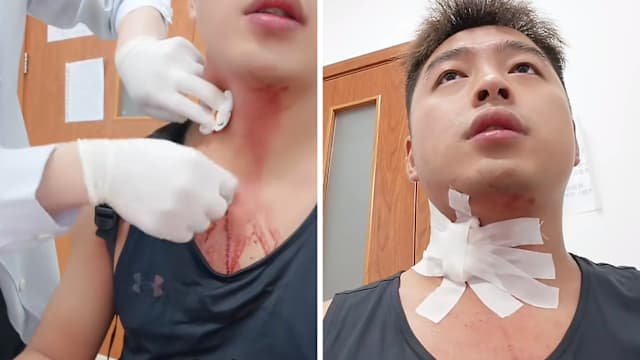 上海男子被蚊子叮咬 抓挠致颈部流血40多分钟