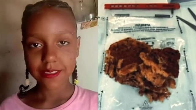 巴西妇女被指制作毒蛋糕毒死孙女被捕