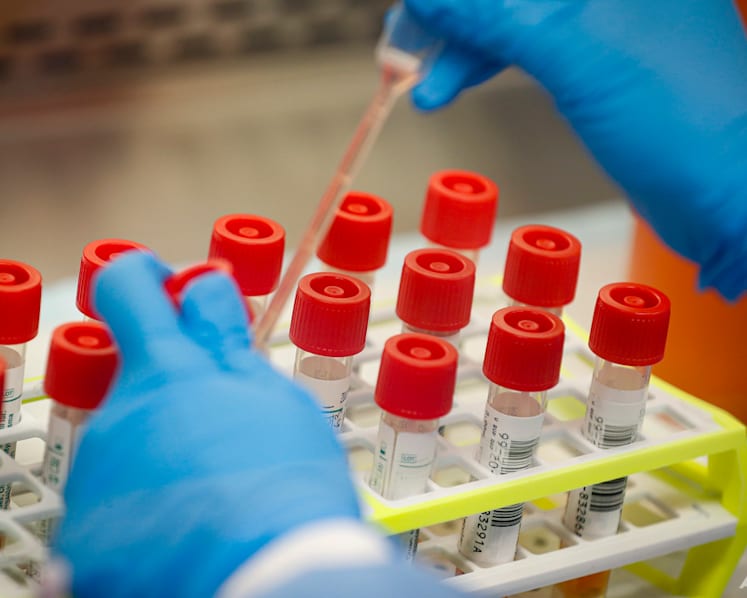 Commentary: Long COVID is real. Now the evidence is piling up