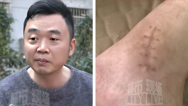 被高薪工作诱骗到电诈园 中国男子跳楼逃生险被活埋