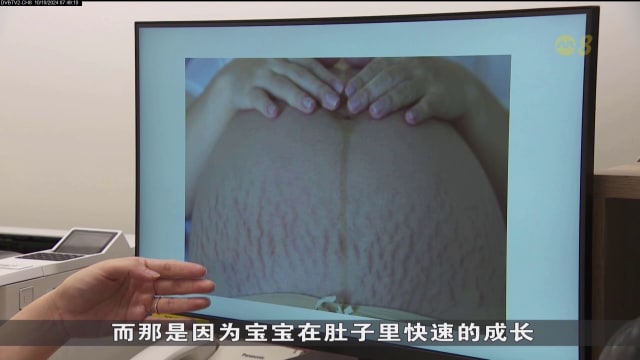 狮城有约 | 助你好孕：爱美孕妇
