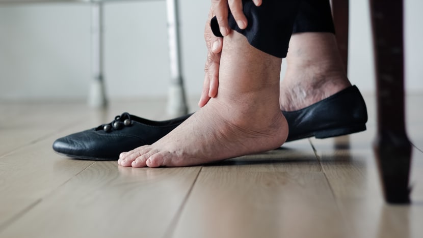Dari kepala hingga kaki: Kenali gejala diabetes yang sering tidak disadari