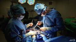 Related article image