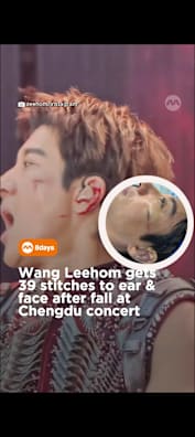 Despite the injuries, he still finished the 3-hour show. #8dayssgAsianEnt  #8dayssg #wangleehom #concertmishap #stitches 