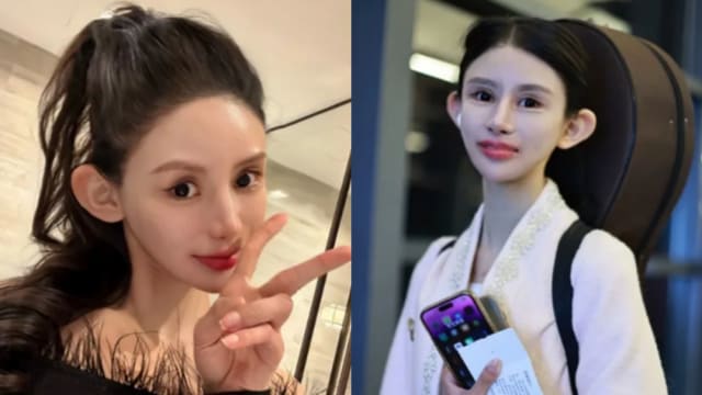 中国网红13岁就整形　网忧心：这真的好看吗？