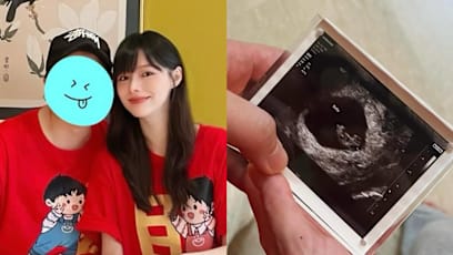 Local Actress Angel Lim Is 4 Months Pregnant… And Has Been Married For Over A Year