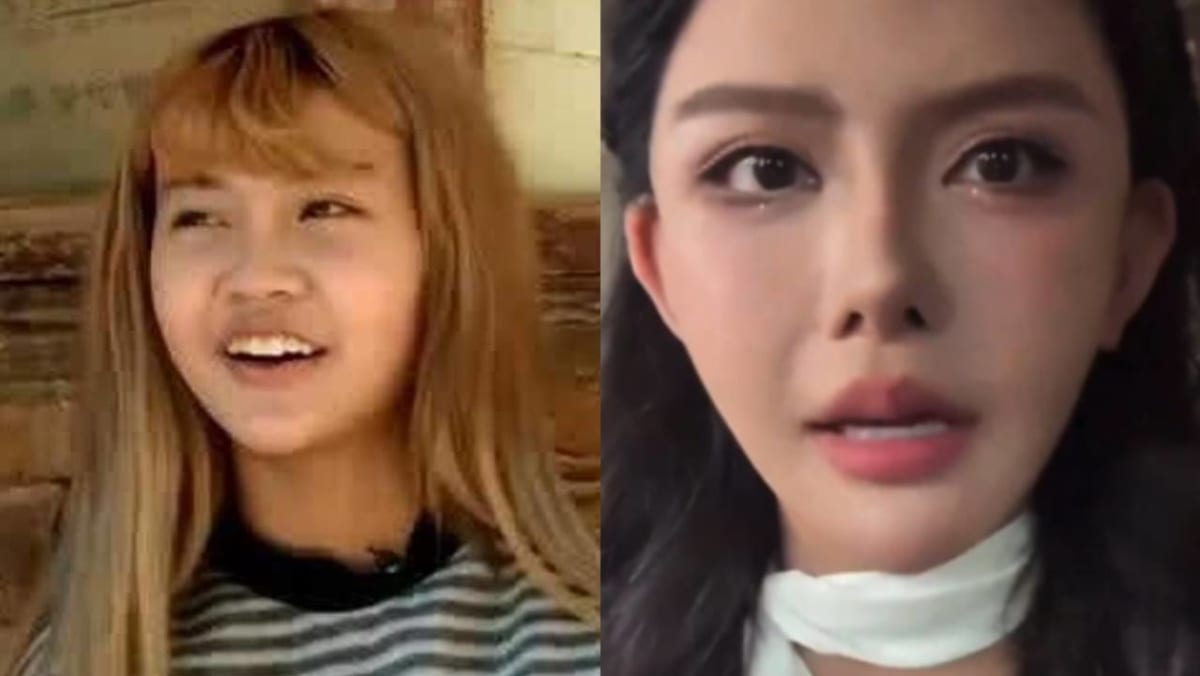 Chinese Influencer Has Difficulty Breathing After Shrinking Nostrils