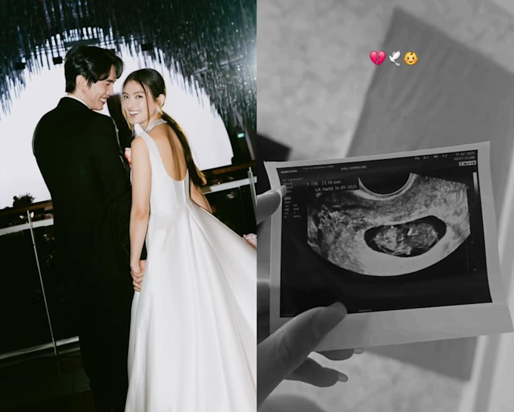 Singaporean celebrity couple Hong Ling and Nick Teo share news of miscarriage