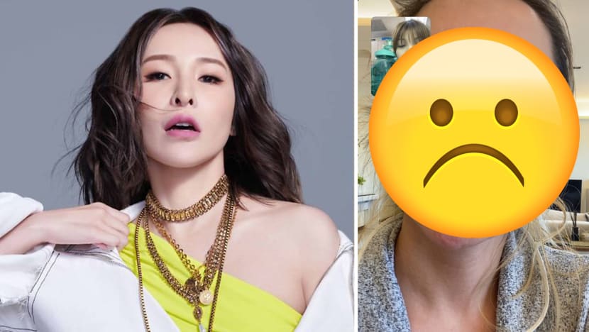 Elva Hsiao Reveals Facial Scar After Dog Attack, Says Her Skin Tissue Is Dead