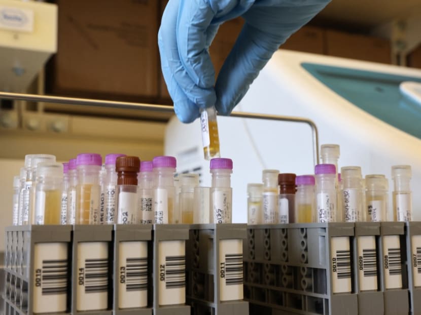 FAQ: What you need to know about Novavax's non-mRNA COVID-19 vaccine Nuvaxovid FAQ: What you need to know about Novavax's non-mRNA COVID-19 vaccine Nuvaxovid