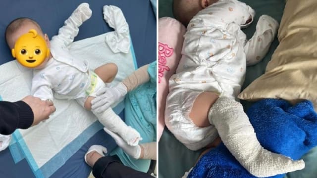 男婴送保姆照顾两周右腿骨断 马国母亲事后方知对方有前科