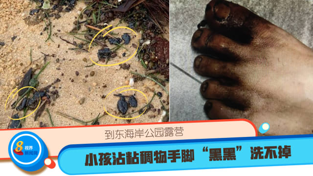 到东海岸公园露营 小孩沾粘稠物手脚“黑黑”洗不掉