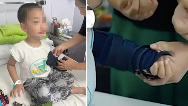 把雨伞当降落伞从高楼跳下 中国男童三个月逐渐康复