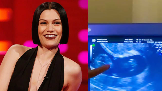 曾心痛流产　Jessie J时隔1年多惊喜宣布好消息！