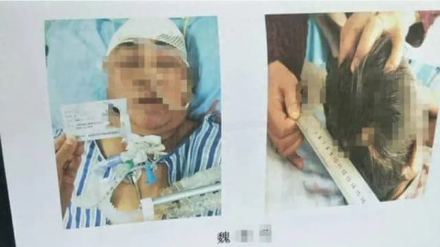 目睹母亲出车祸受惊吓 中国女子五天后死亡