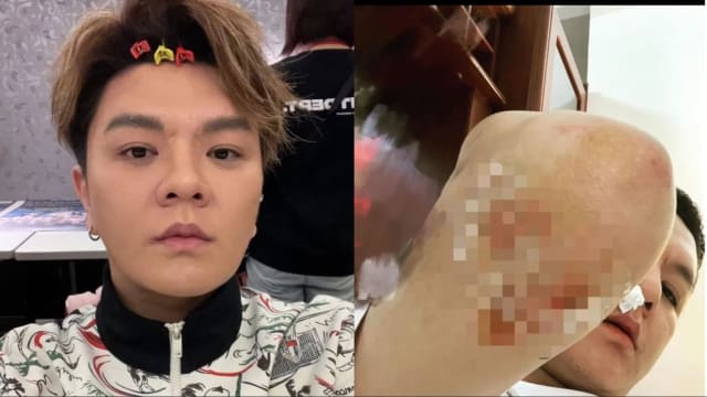 贺一航儿子出车祸　曾治豪险些命丧现场