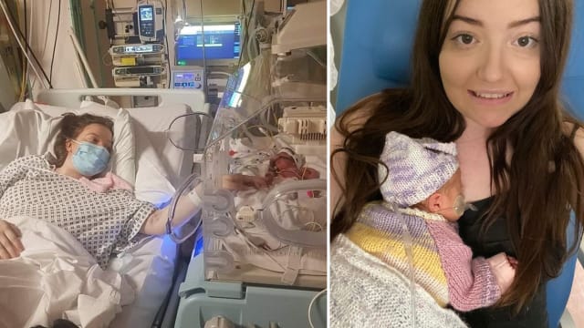 脚趾突然不能动 英国孕妇患脑瘤30周剖腹产子