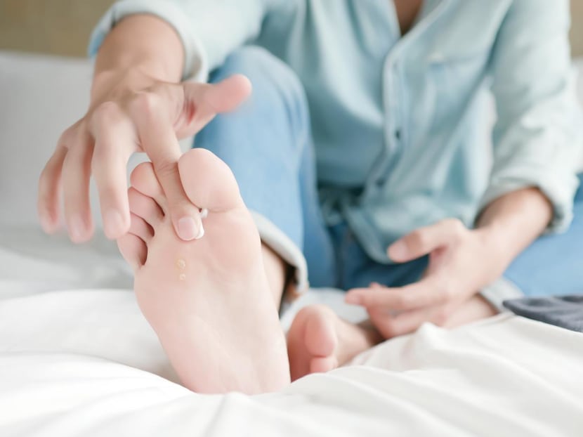 How do you know if that red, itchy rash is a fungal infection or not? 