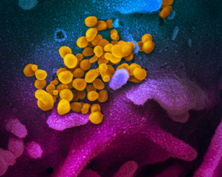 Third Covid-19 antibody treatment in Singapore in the works; human trials likely in coming months