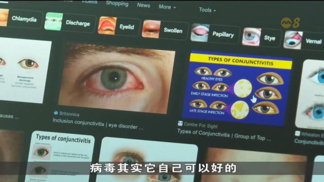 红眼症病例今年呈上升趋势 眼科医生：上呼吸道感染的病毒容易引发