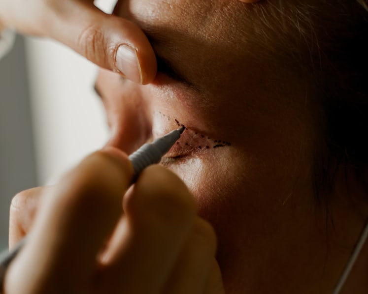 Beautician gets jail for unlicensed procedure that worsened woman's drooping eyelid