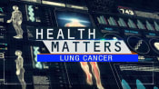 Lung Cancer