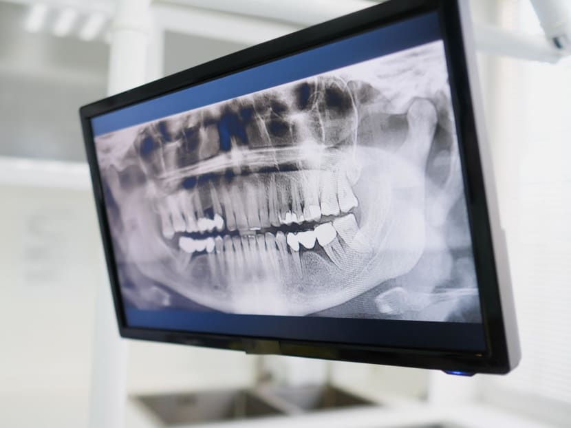 A stock photo of a dental X-ray. A stock photo of a dental X-ray.
