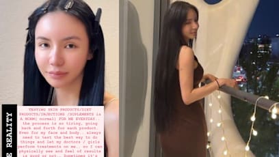 Kim Lim Intentionally Gained 7kg To Test Weight-Loss Products For Her Brand