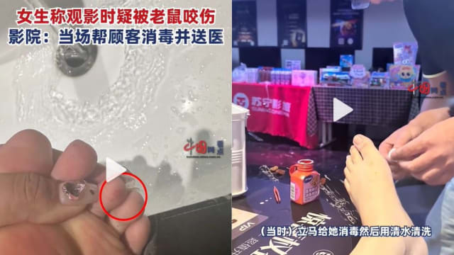 看电影疑被老鼠咬伤脚趾 中国女子打四针狂犬疫苗