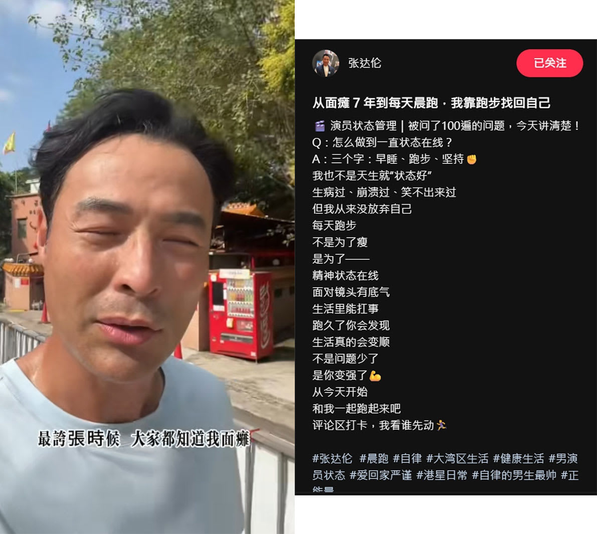前TVB绿叶张达伦自曝曾面瘫7年！连基本喝水动作都做不到 - vibes by 8world