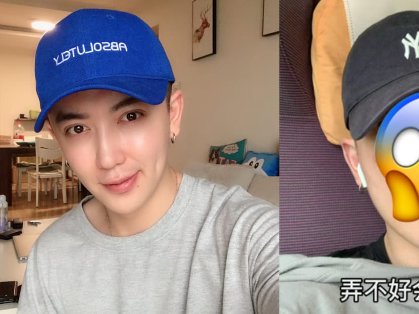 Jin Dawei Abel, who has 1.4 million followers on the platform, is now telling others to think twice before going for plastic surgery. Jin Dawei Abel, who has 1.4 million followers on the platform, is now telling others to think twice before going for plastic surgery.