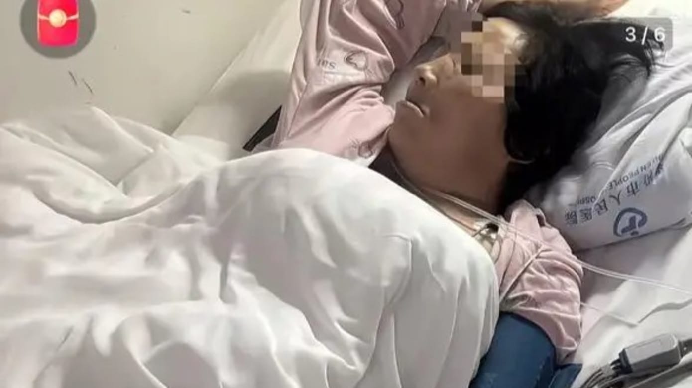 一次性拔12颗牙 中国山西妇女突发心梗休克