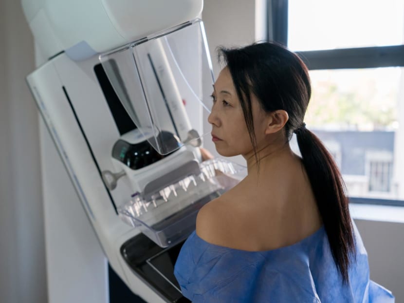 Breast lumps, mammograms, mastectomy: 13 questions about breast cancer from Singapore women aged 20 to 70 Breast lumps, mammograms, mastectomy: 13 questions about breast cancer from Singapore women aged 20 to 70