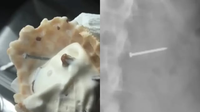  吃冰淇淋误吞钉子致永久不孕 女子获1800万元赔偿