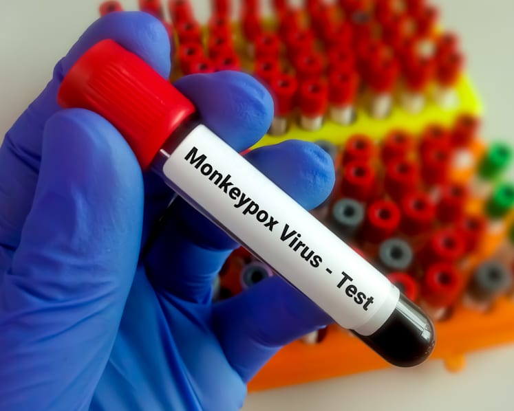 Singapore reports 10th case of monkeypox infection