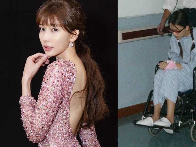 Lin Chiling Broke 6 Ribs Falling From A Horse 17 Years Ago; Had No Health Insurance To Cover Her Medical Fees