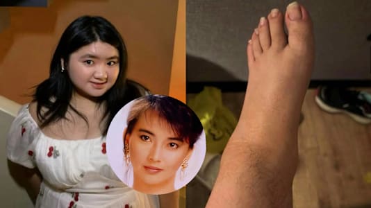 Daughter Of '80s Taiwanese Actress Hu Huichung Praised For Showing Her Unshaven Legs In Pics