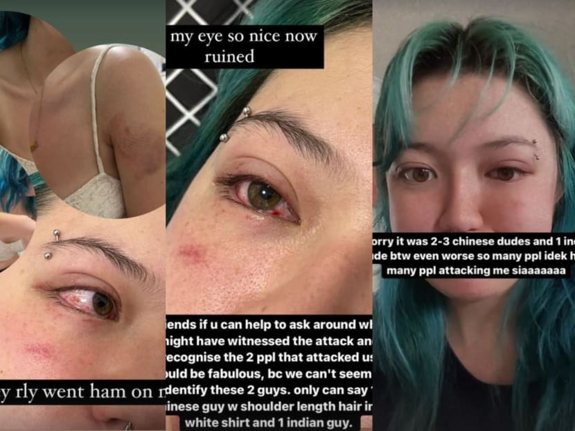 Ms Leeanne O’Donnell (pictured) said that she sustained some injuries to her eye, as well as several other bruises across her upper body. Ms Leeanne O’Donnell (pictured) said that she sustained some injuries to her eye, as well as several other bruises across her upper body.
