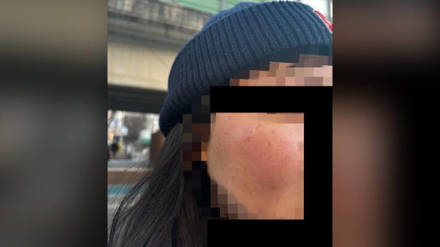 狮城女韩国留学被攻击 脸部被挥拳留下心理阴影