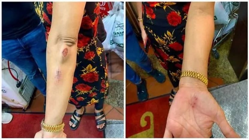 Polis berkas lelaki didakwa lempar kata perkauman, tendang wanita di Choa Chu Kang