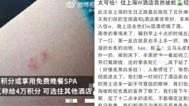 入住五星酒店疑被蛇咬 中国女子不满酒店处理方式
